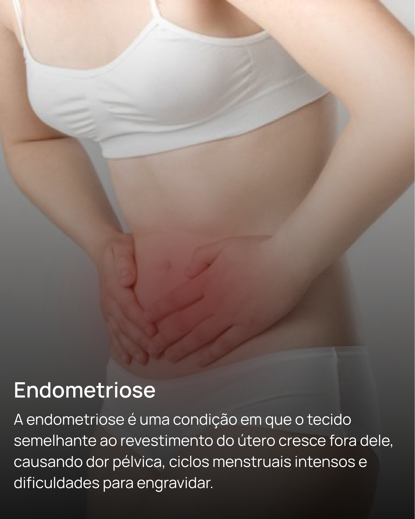 Endometriose
